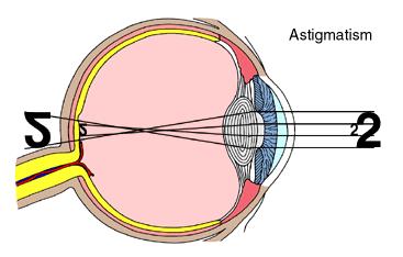 Plaatje bij antwoord