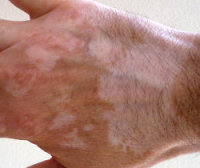 Plaatje bij antwoord