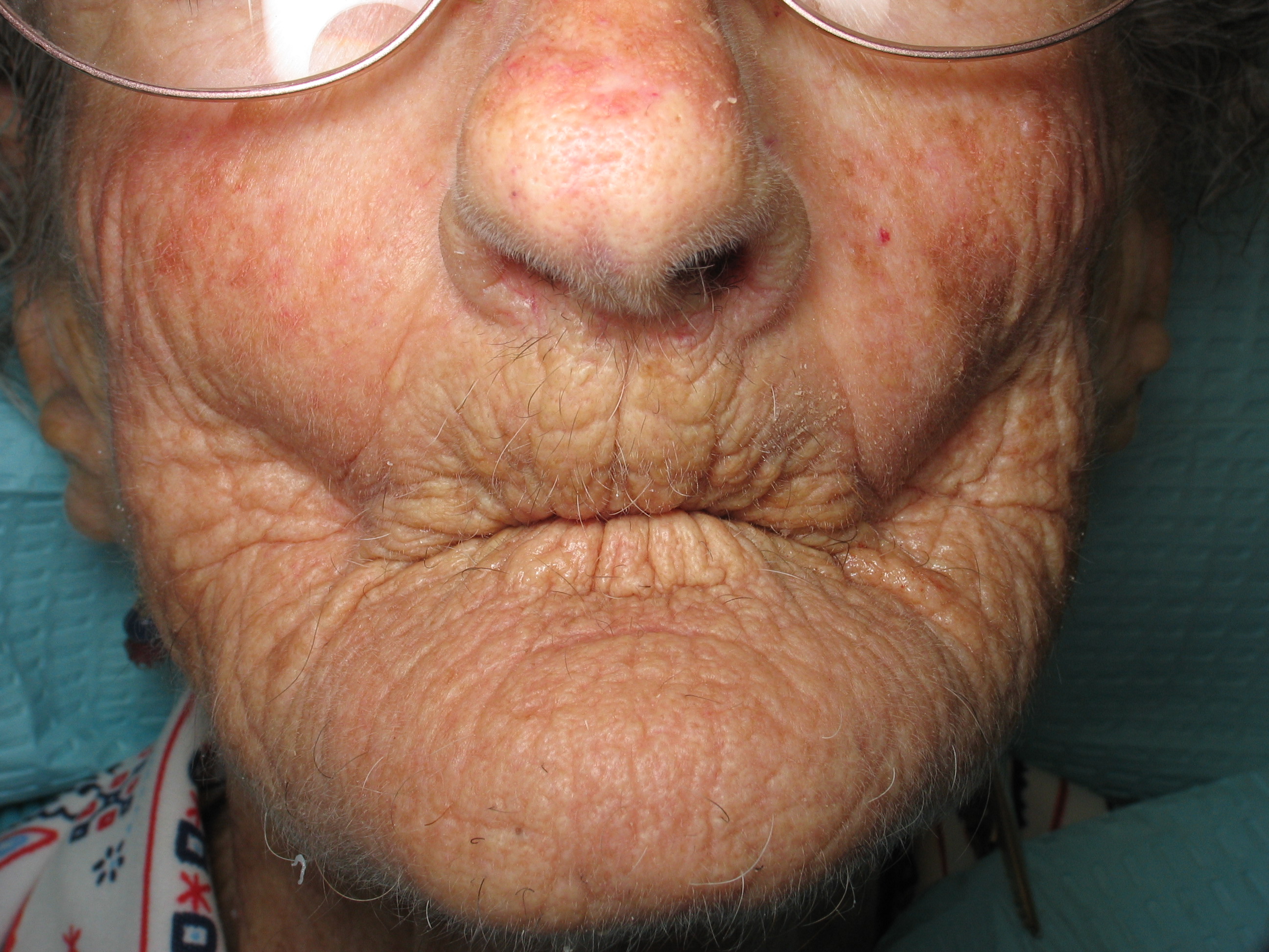 Plaatje bij antwoord