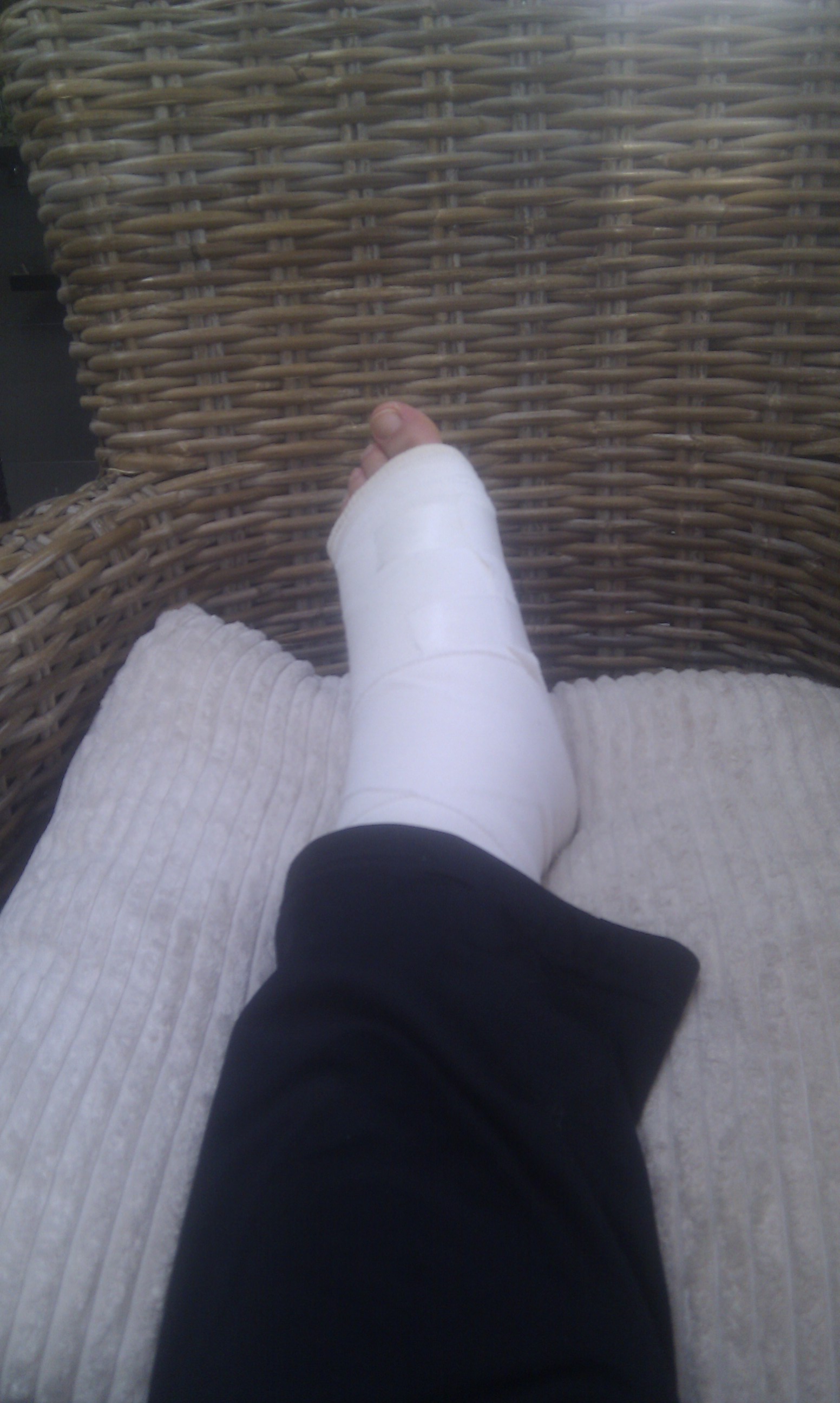 Ik heb momenteel mijn voet in het verband. Hoe kan ik voorkomen dat mijn voet nat wordt