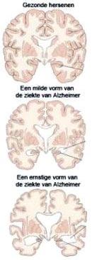 Plaatje bij antwoord