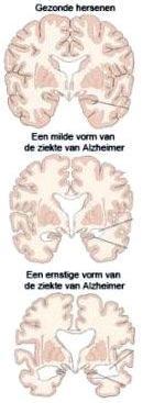 Plaatje bij antwoord