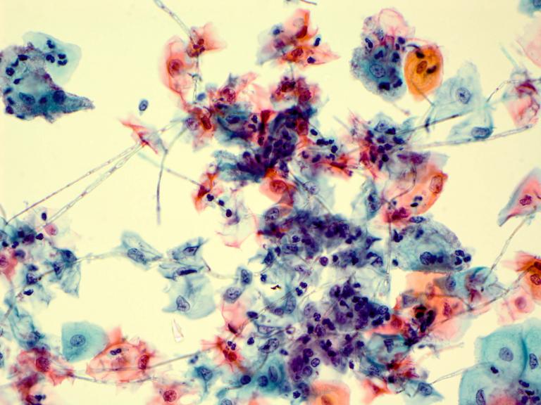 Picture for question