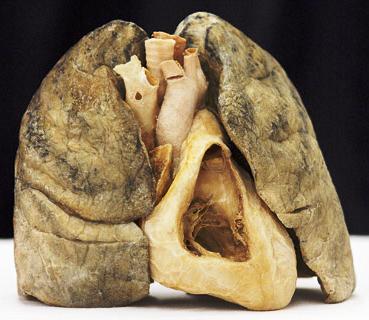 Plaatje bij antwoord