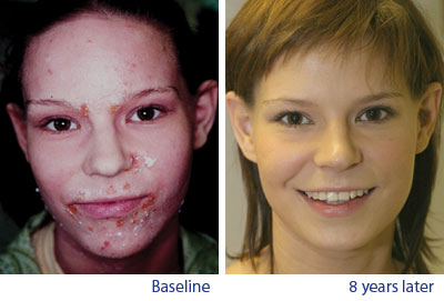 Plaatje bij antwoord