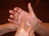 Plaatje bij antwoord