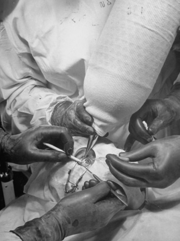 Plaatje bij antwoord