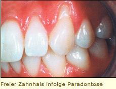 Plaatje bij antwoord