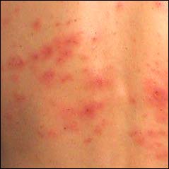 Plaatje bij antwoord