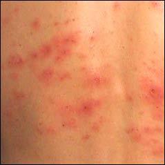 Plaatje bij antwoord