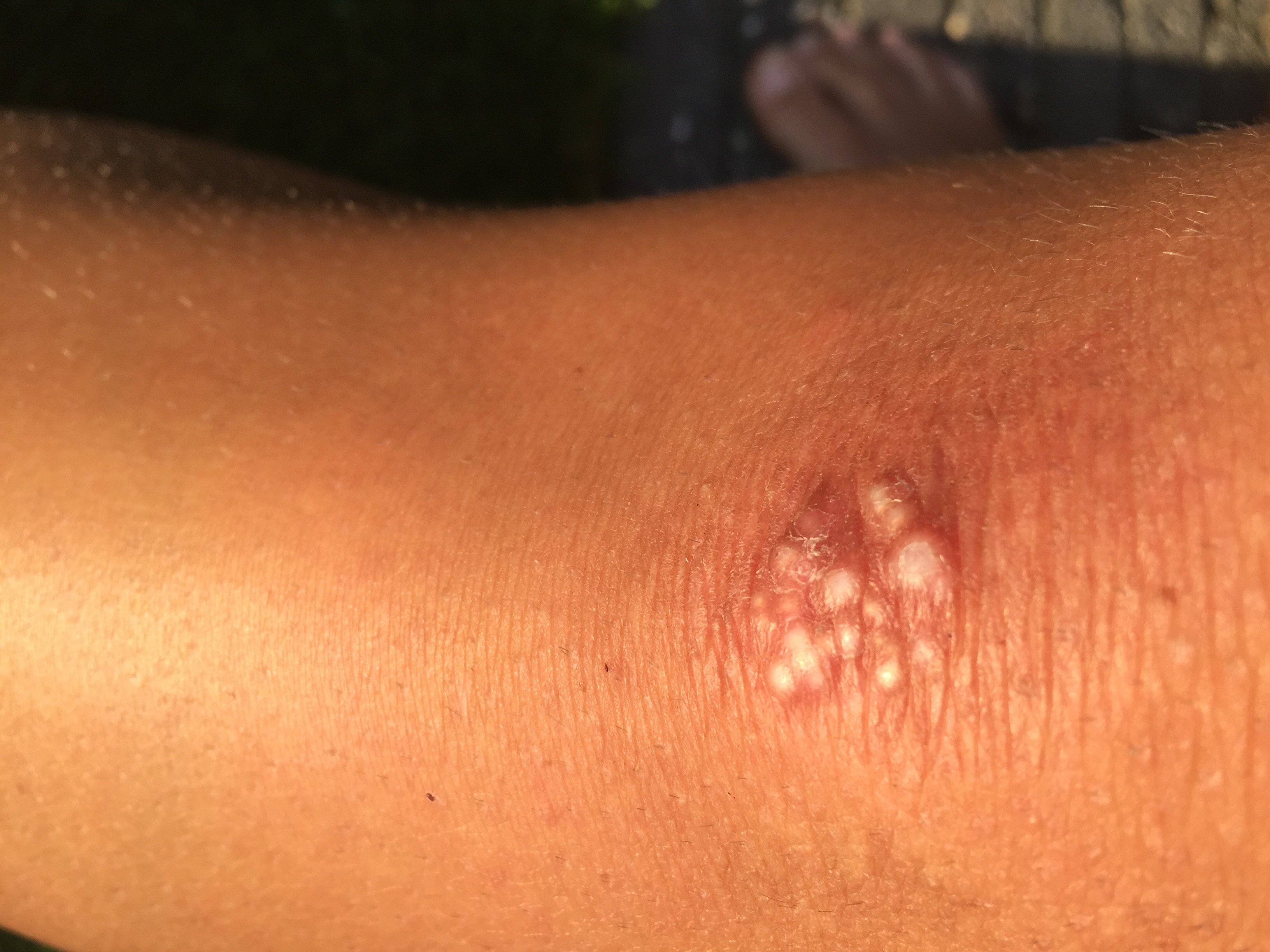 Picture for question