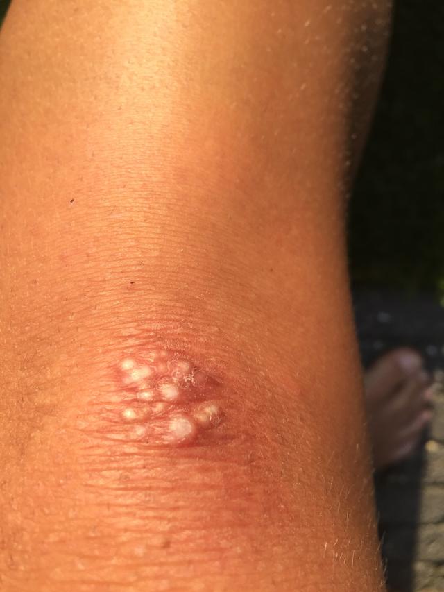 Picture for question