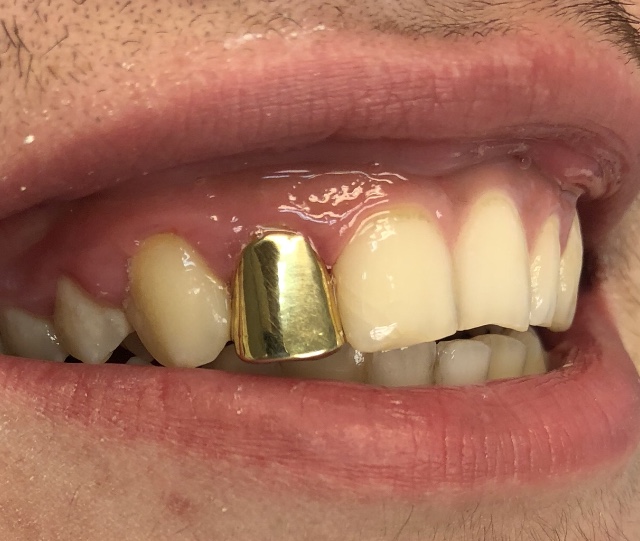 Plaatje bij antwoord