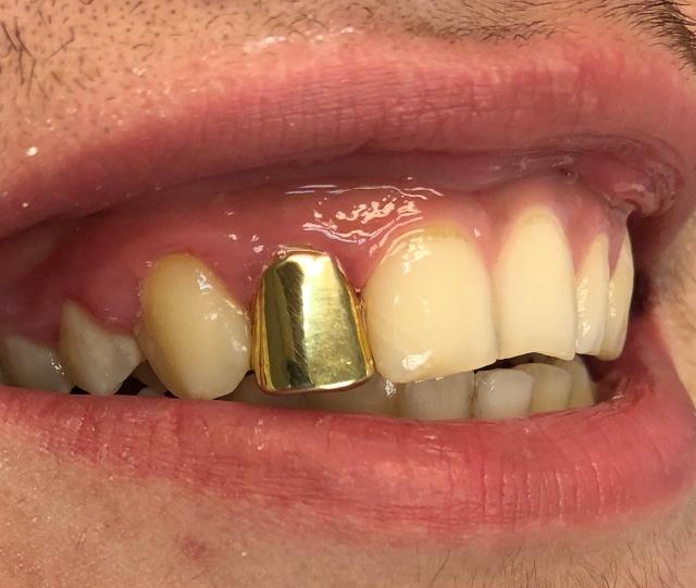 Plaatje bij antwoord