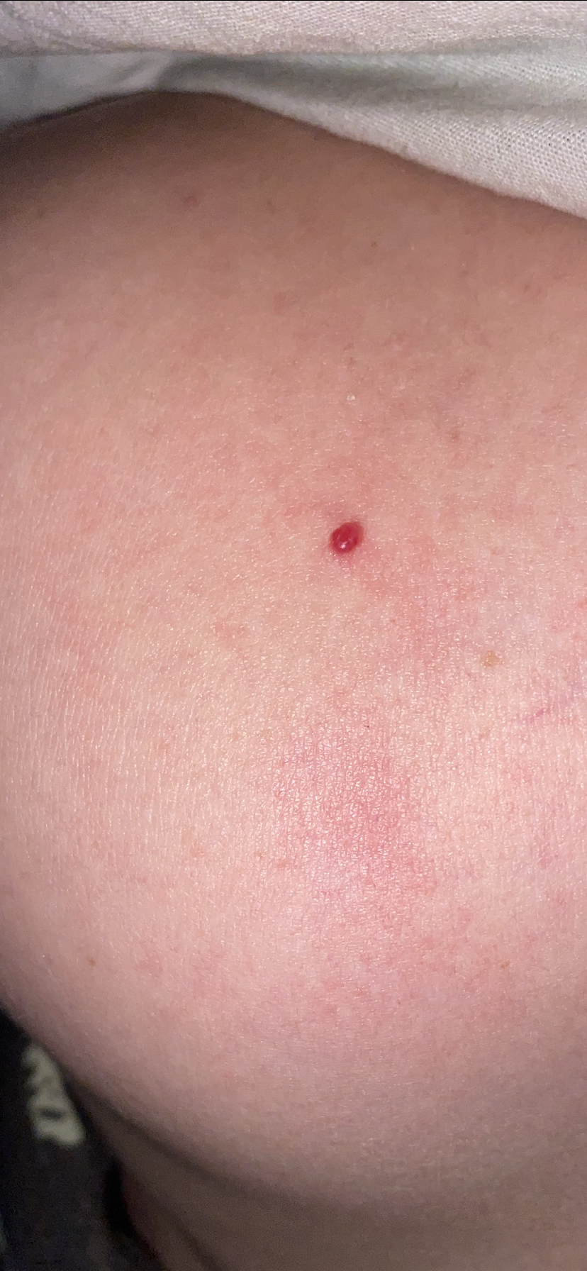 Picture for question