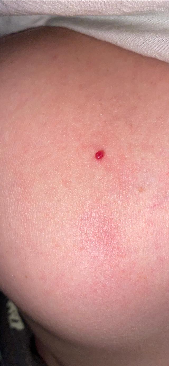 Picture for question