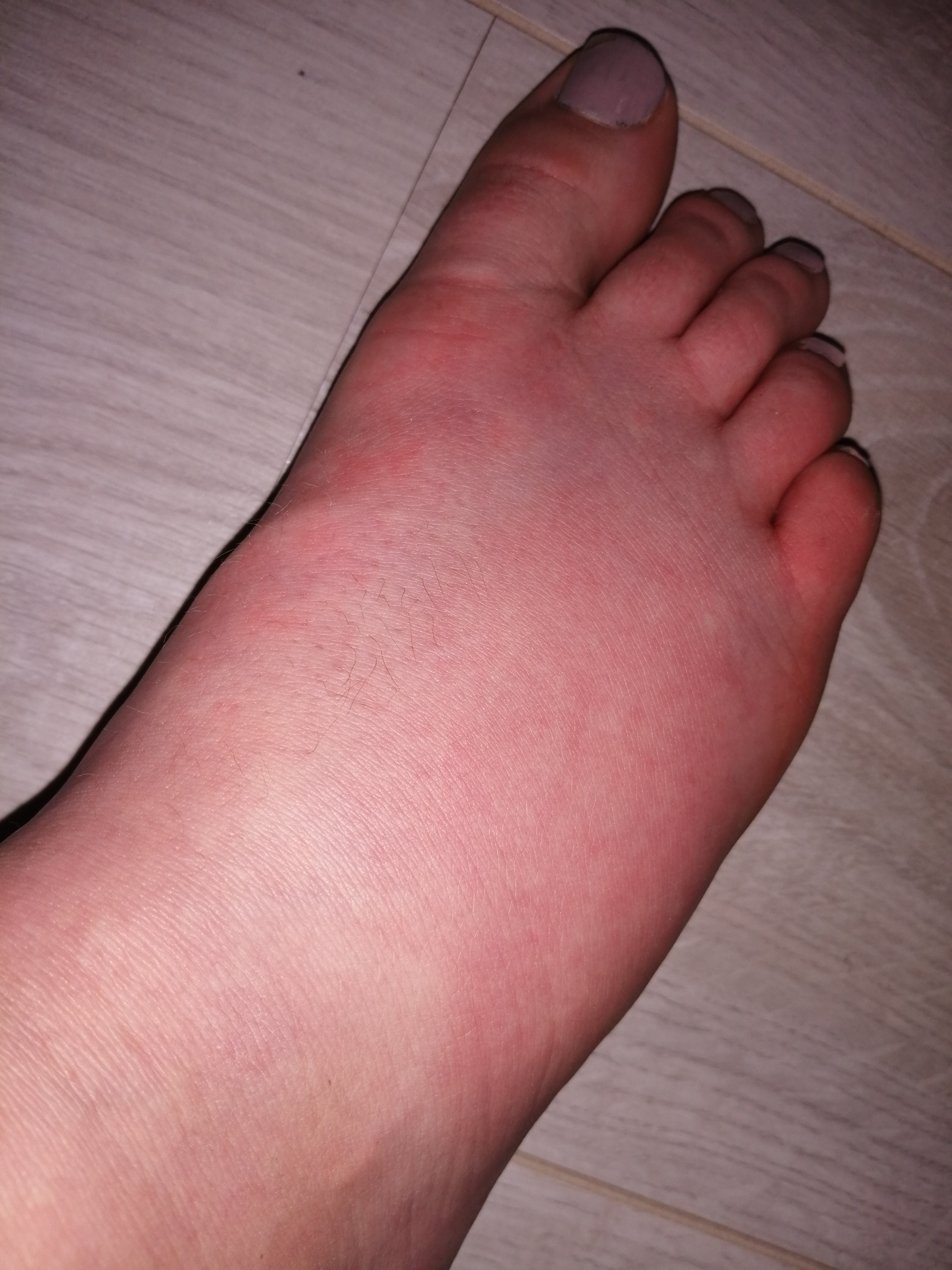 Picture for question