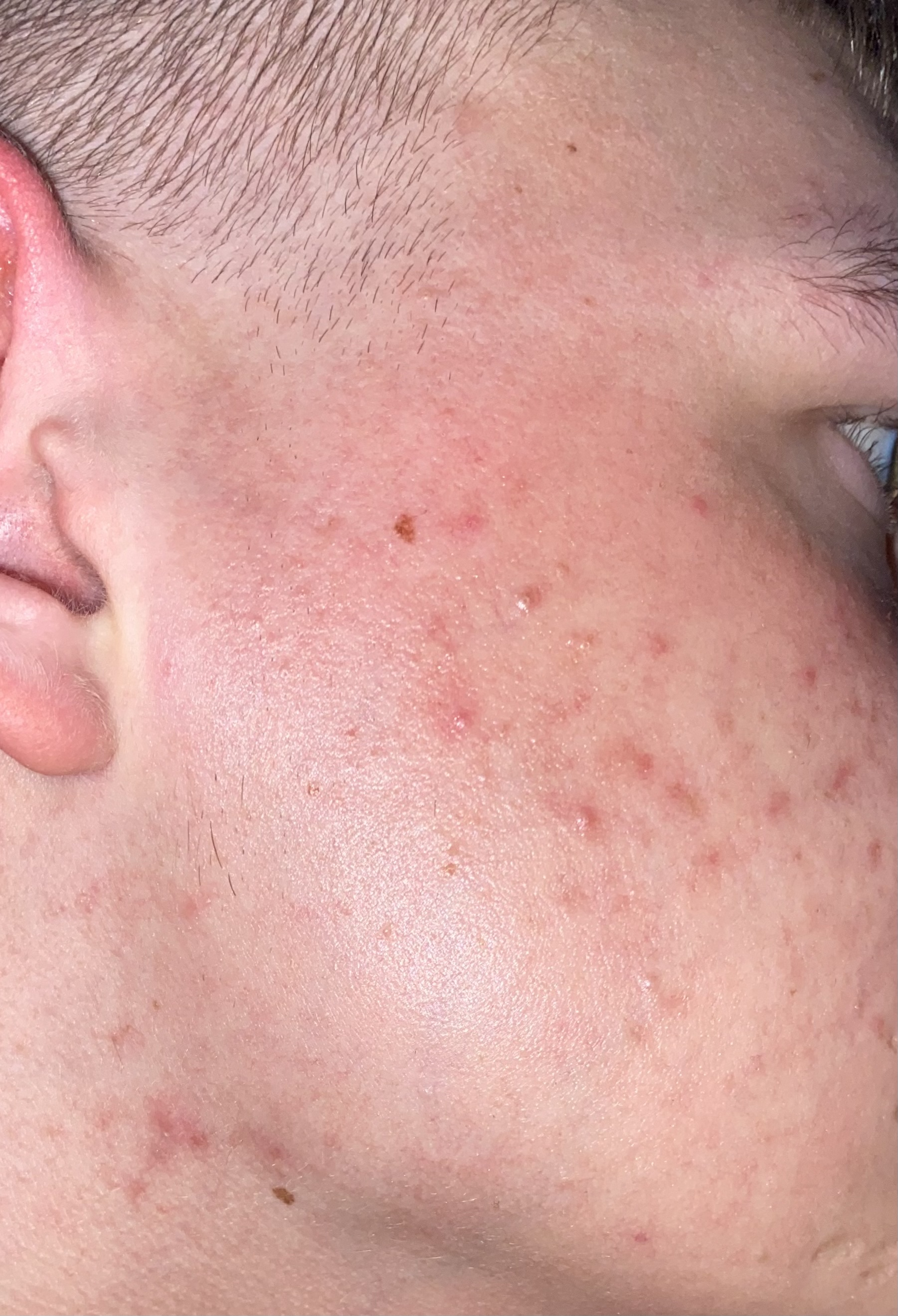 Picture for question