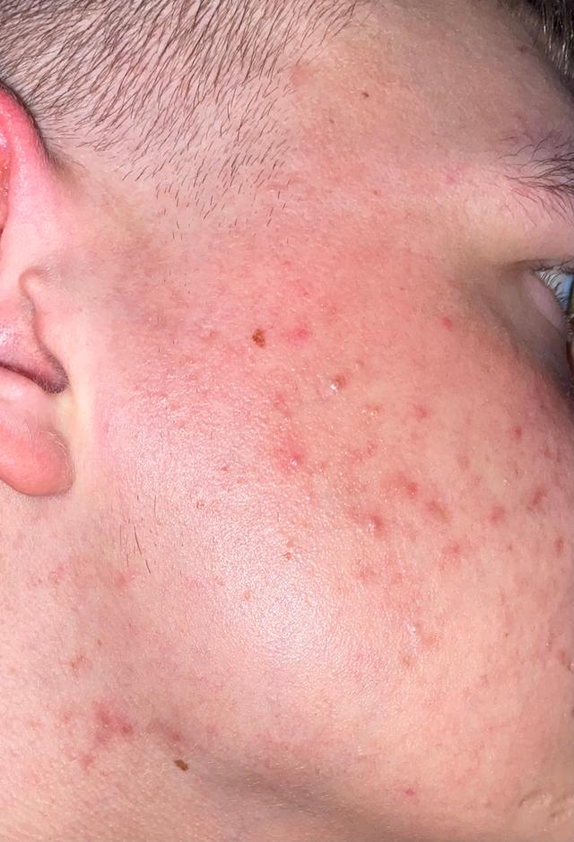 Picture for question