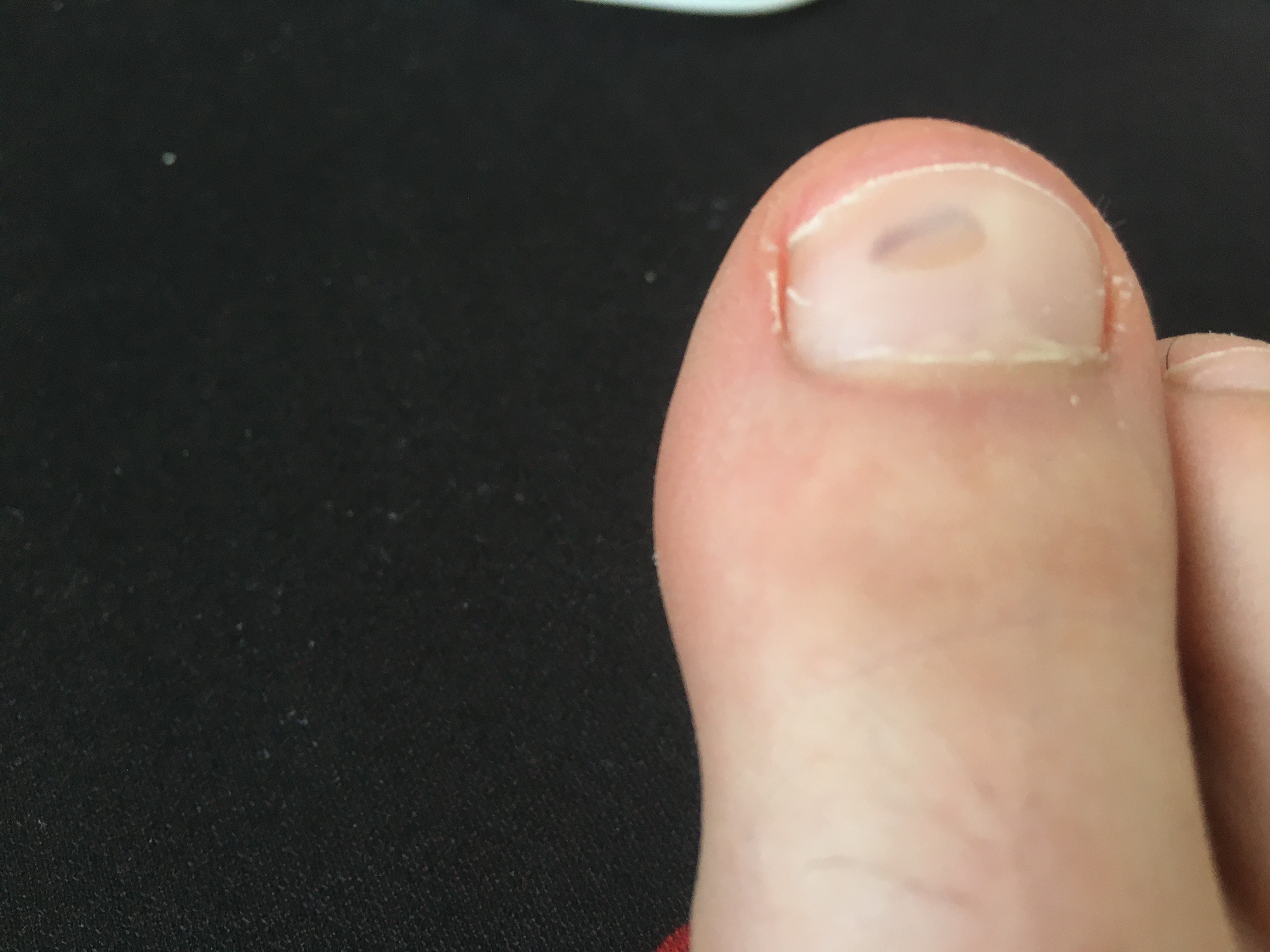 Picture for question