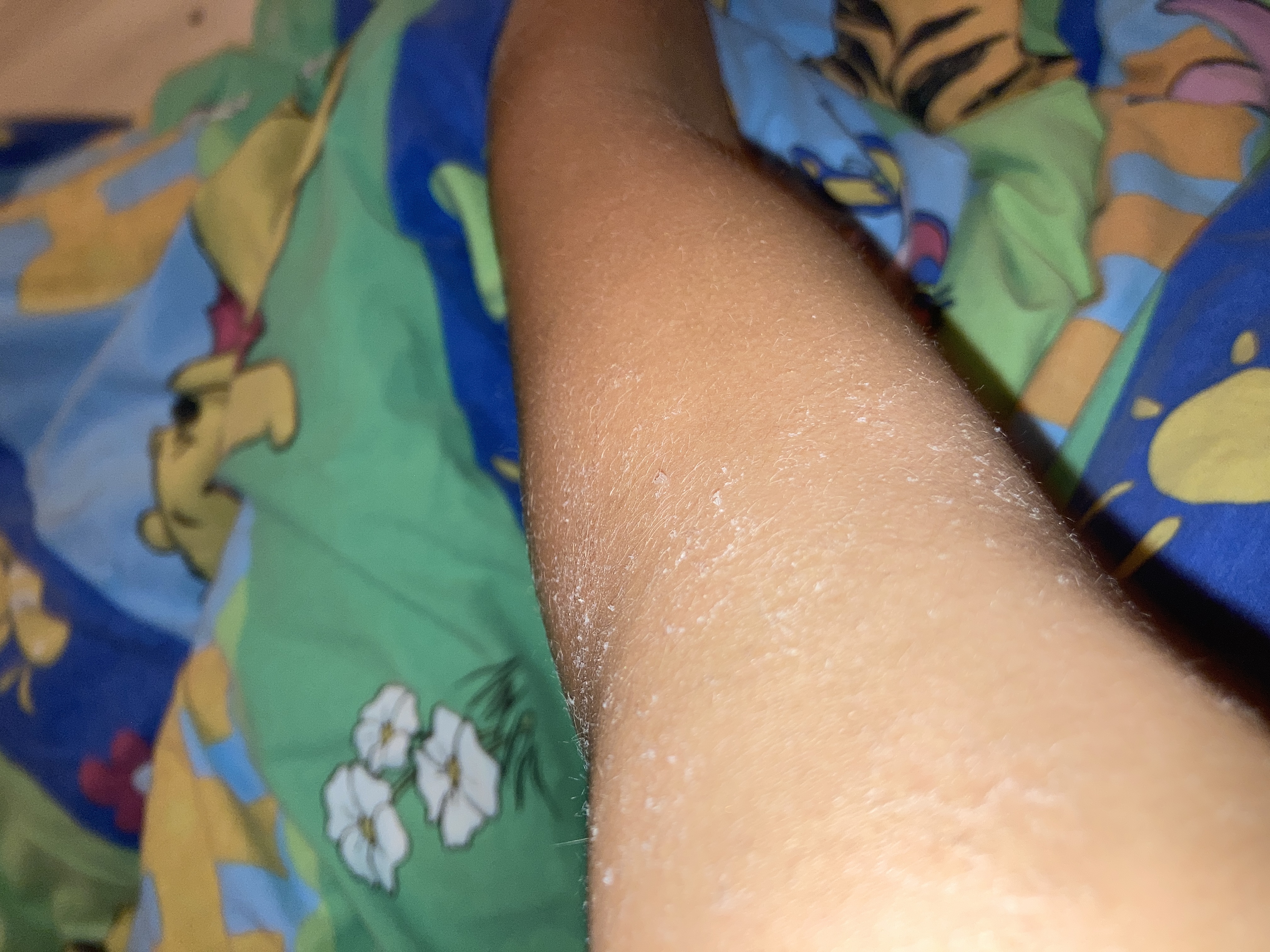 Picture for question