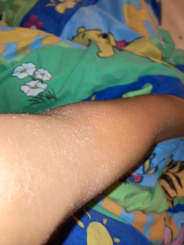 Picture for question