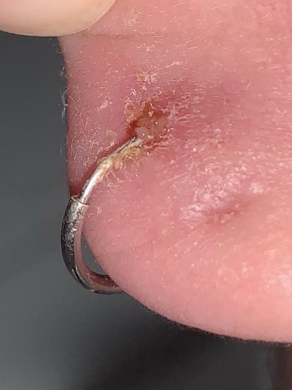 Picture for question