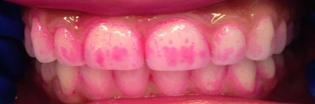 Plaatje bij antwoord