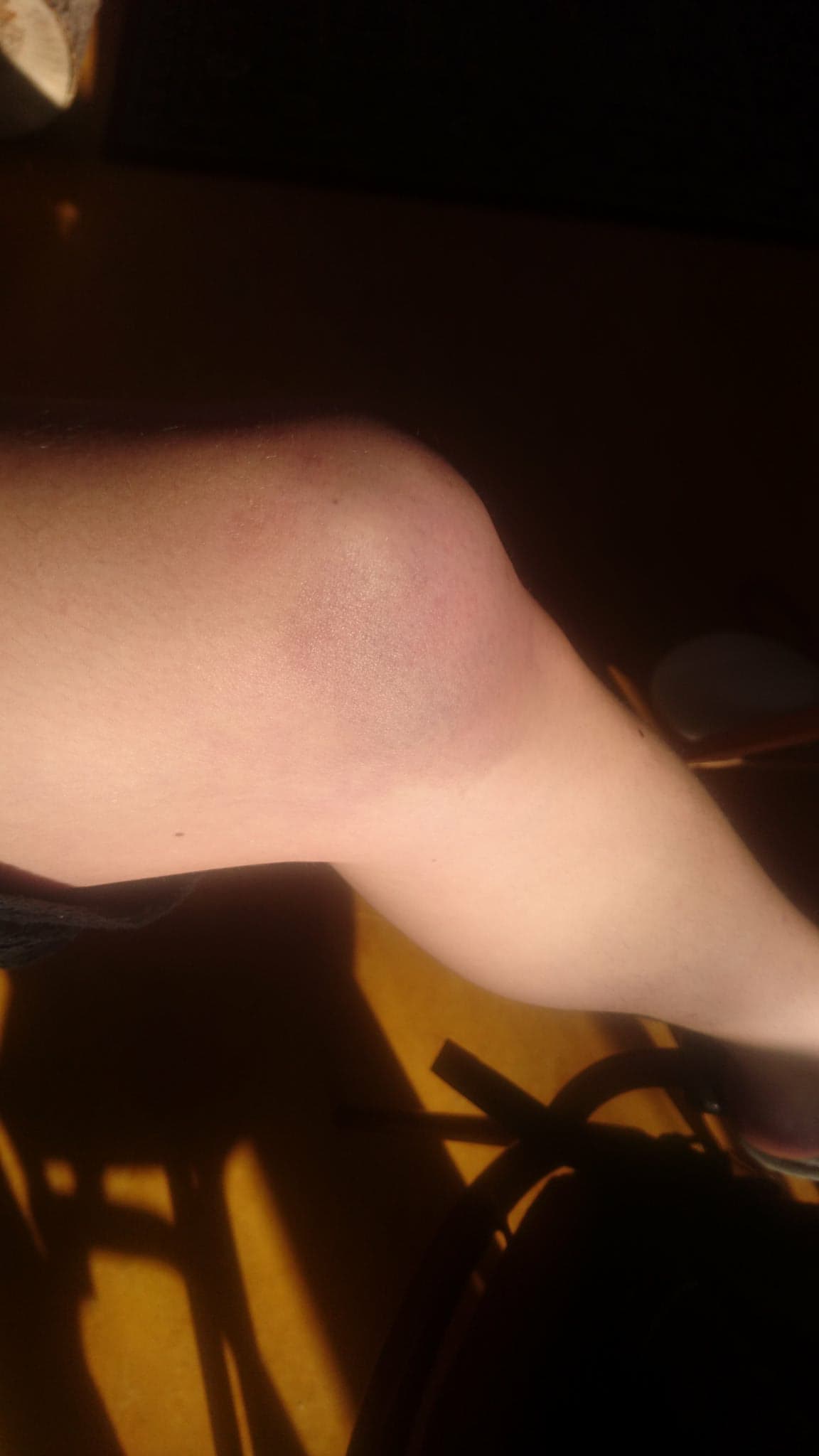 Picture for question