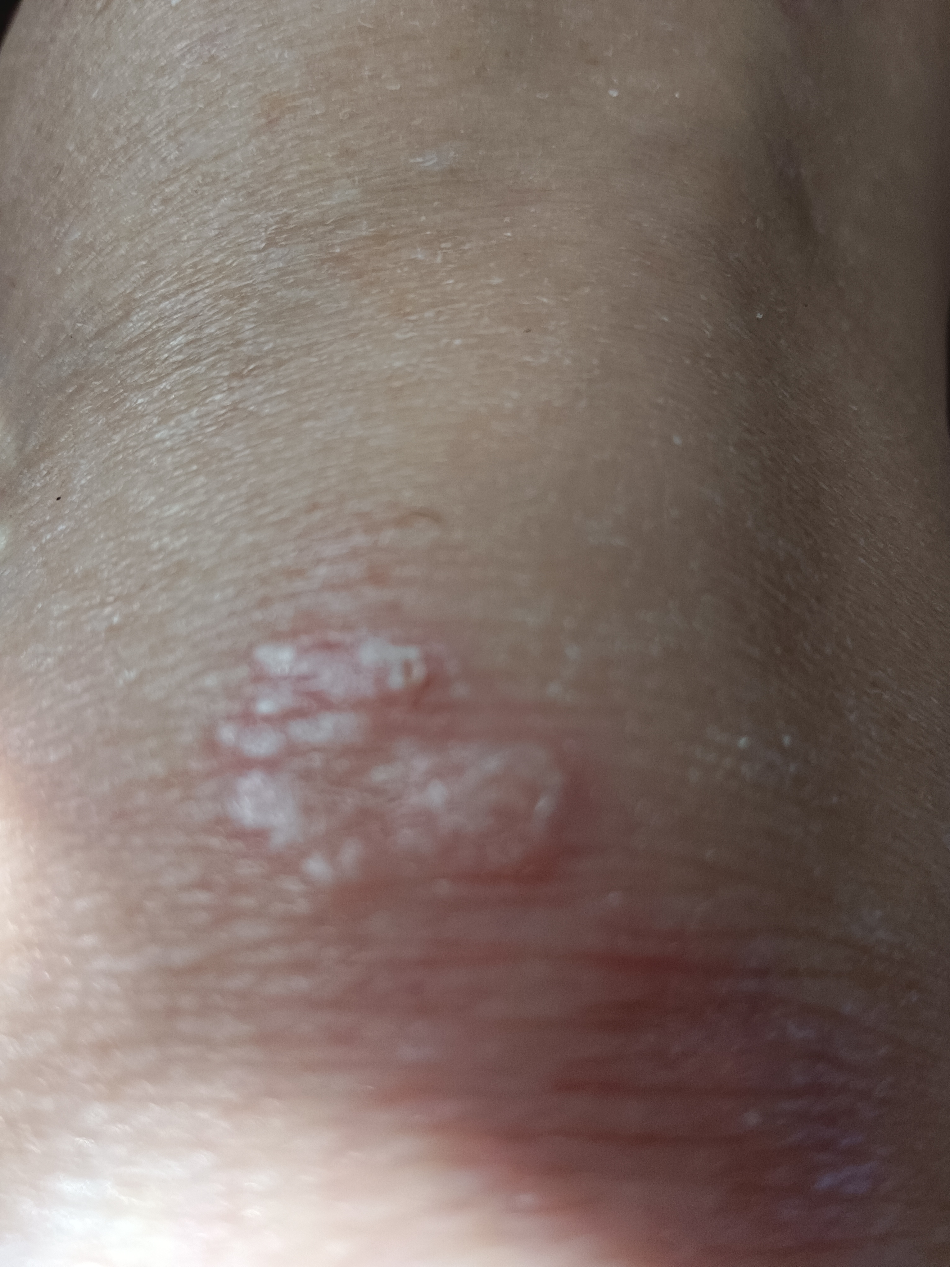 Picture for question