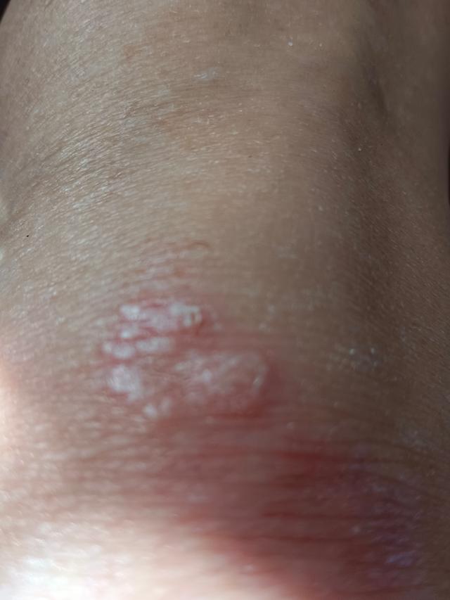 Picture for question