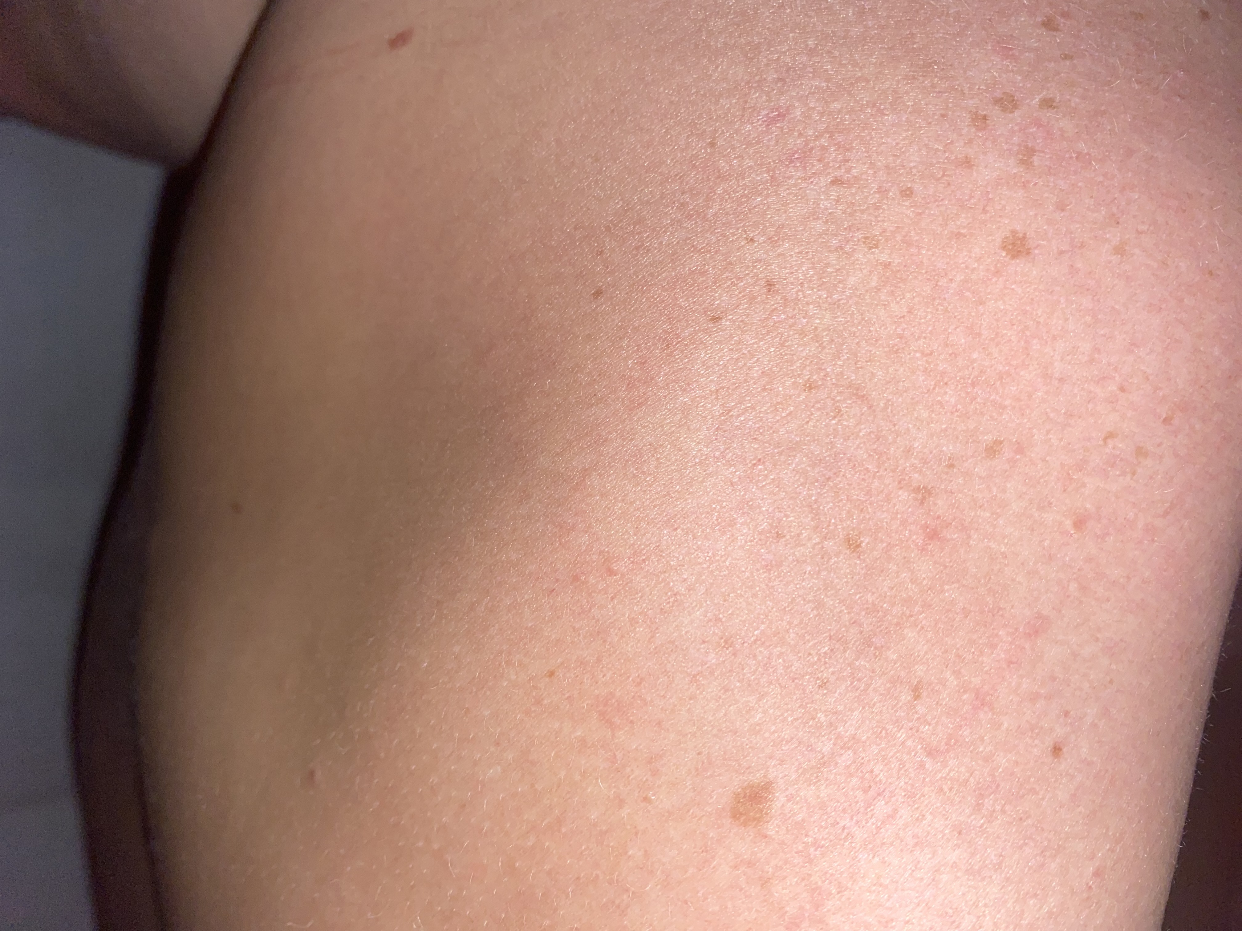 Picture for question