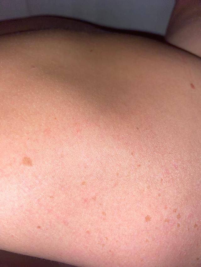 Picture for question