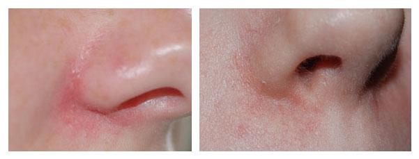 Plaatje bij antwoord