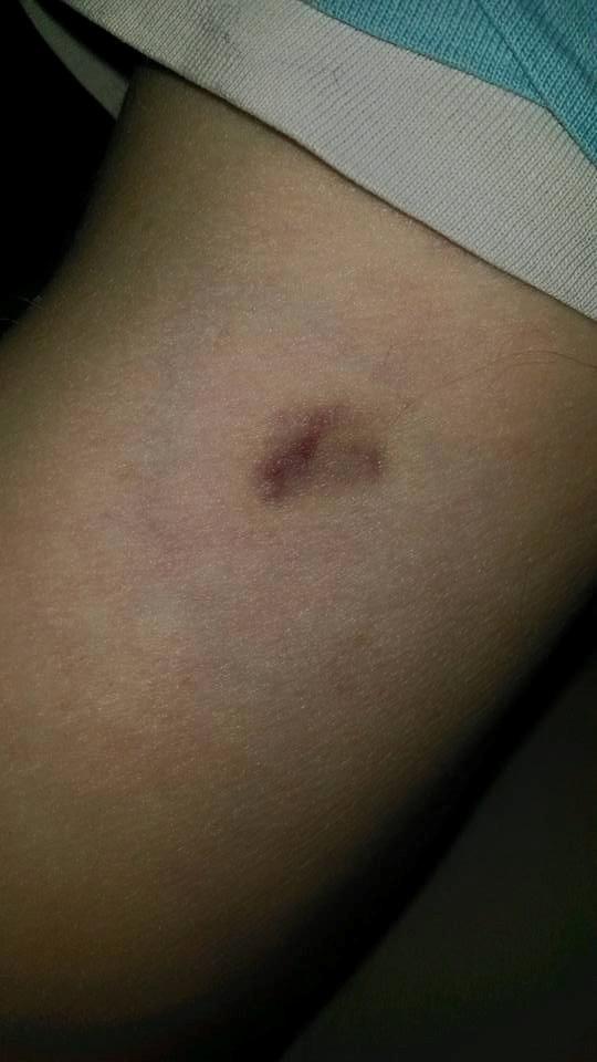 Picture for question