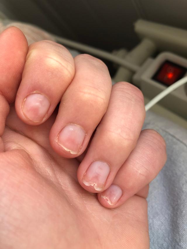 Picture for question