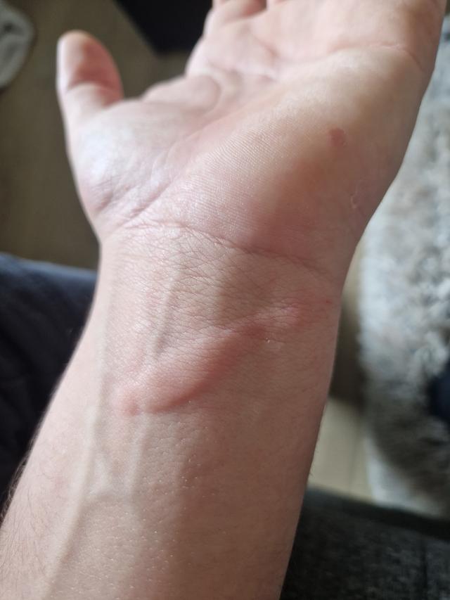 Picture for question