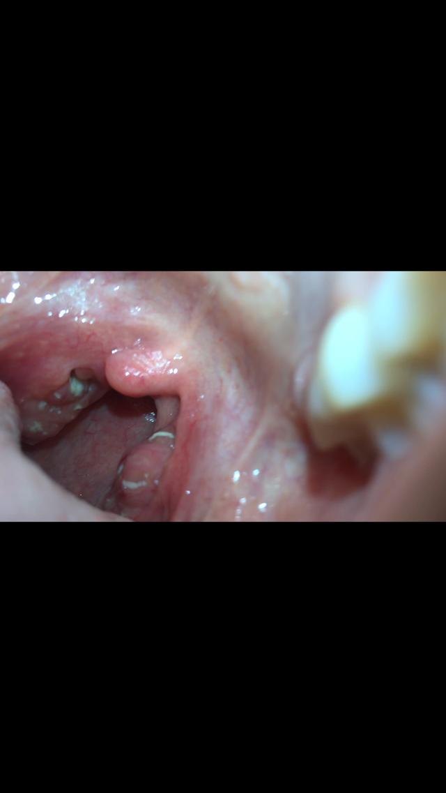 Picture for question