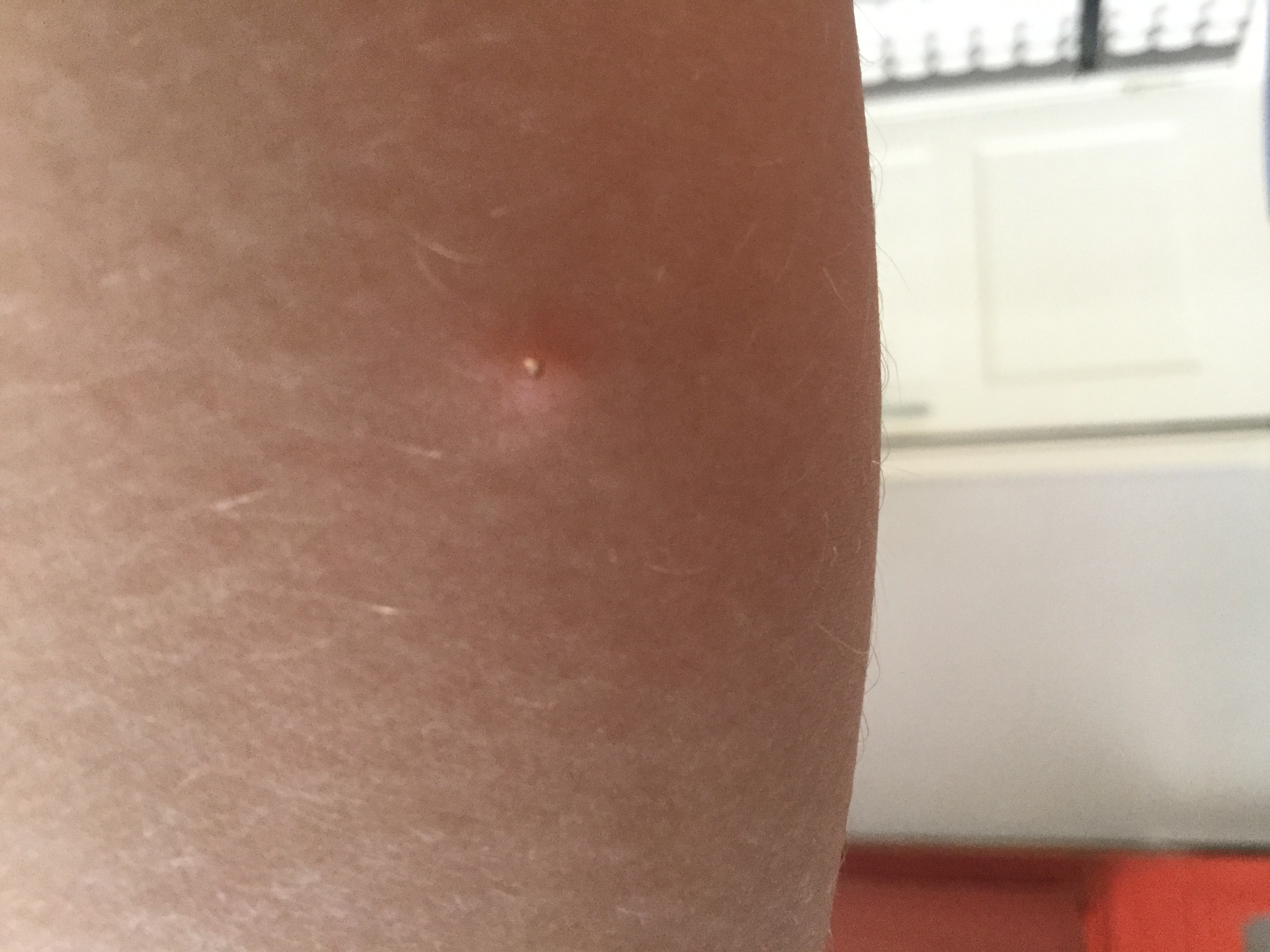 Picture for question