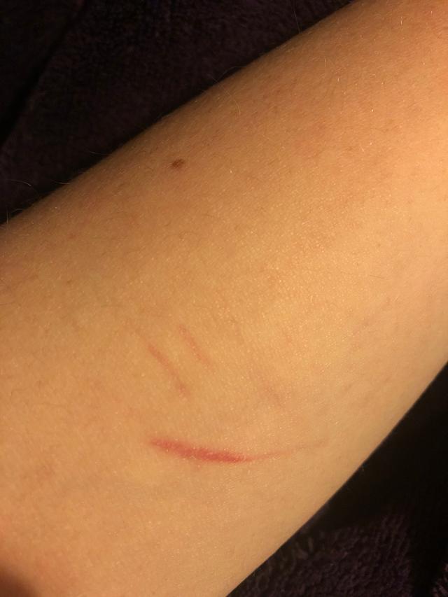 Picture for question