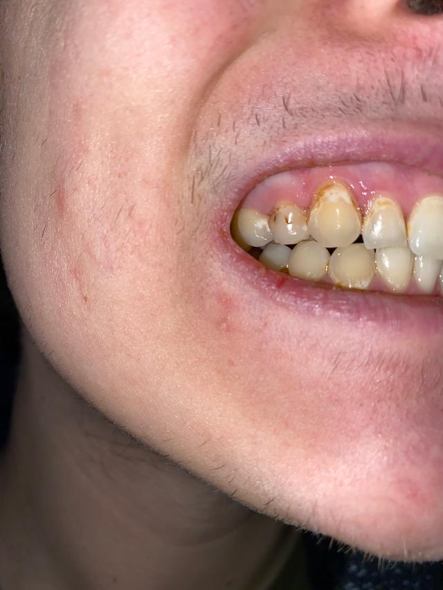 Picture for question