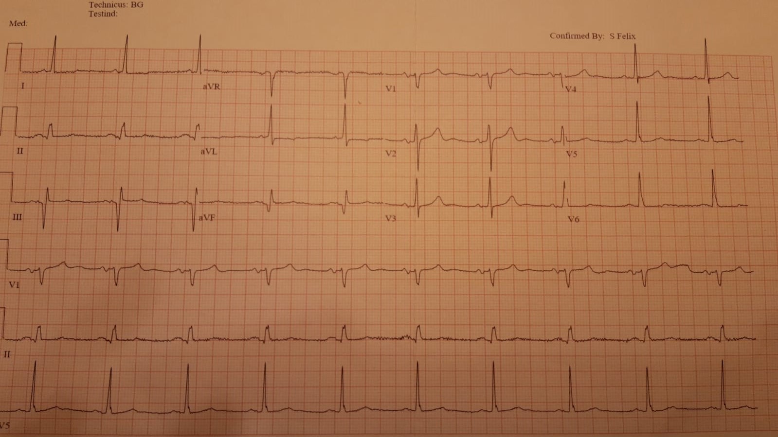 Picture for question