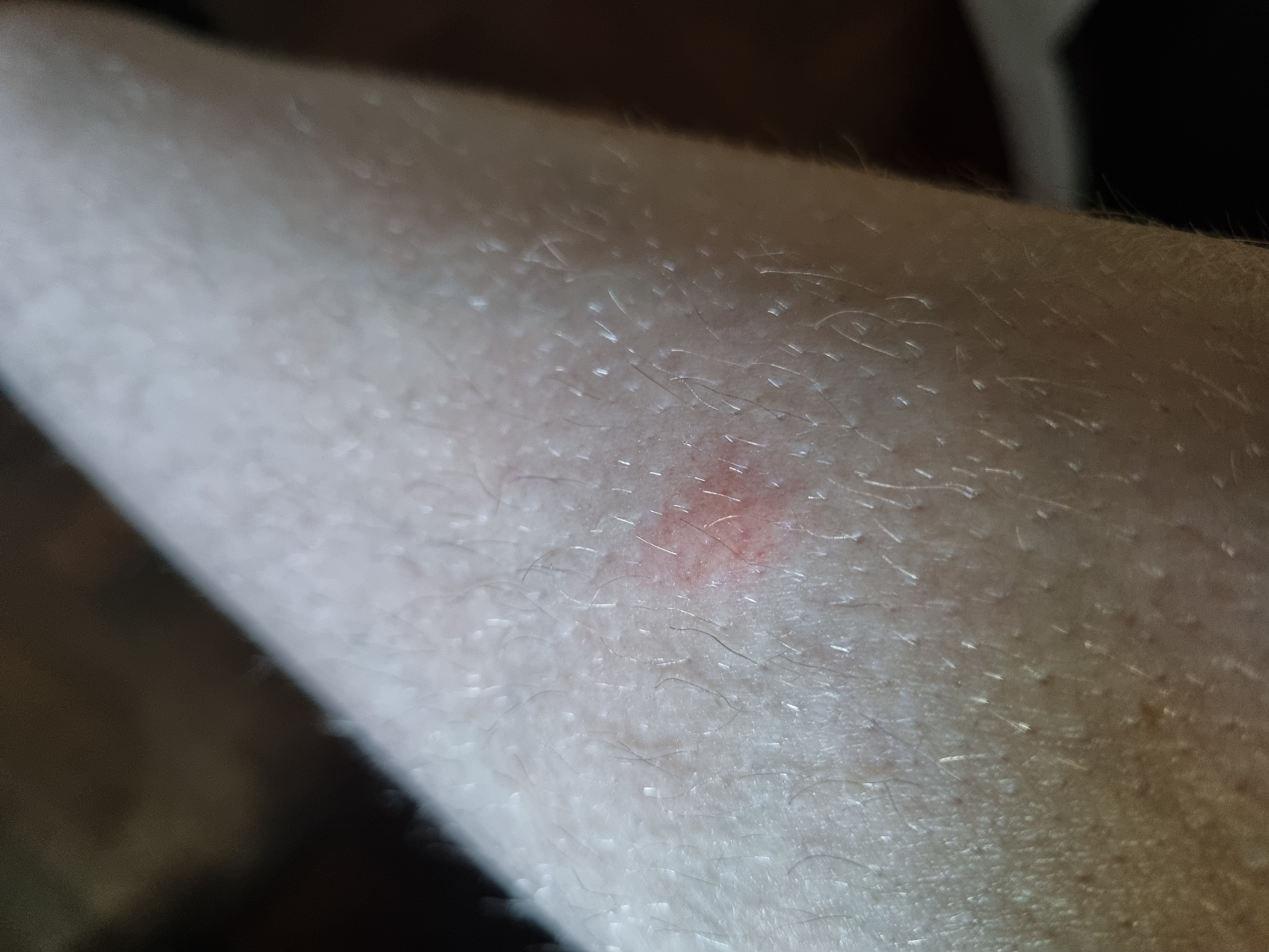 Picture for question