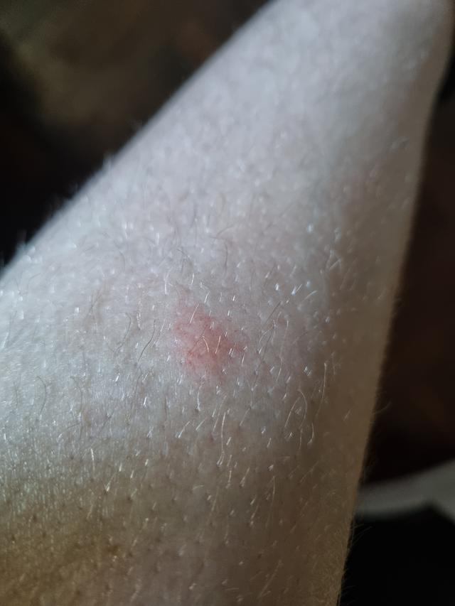 Picture for question