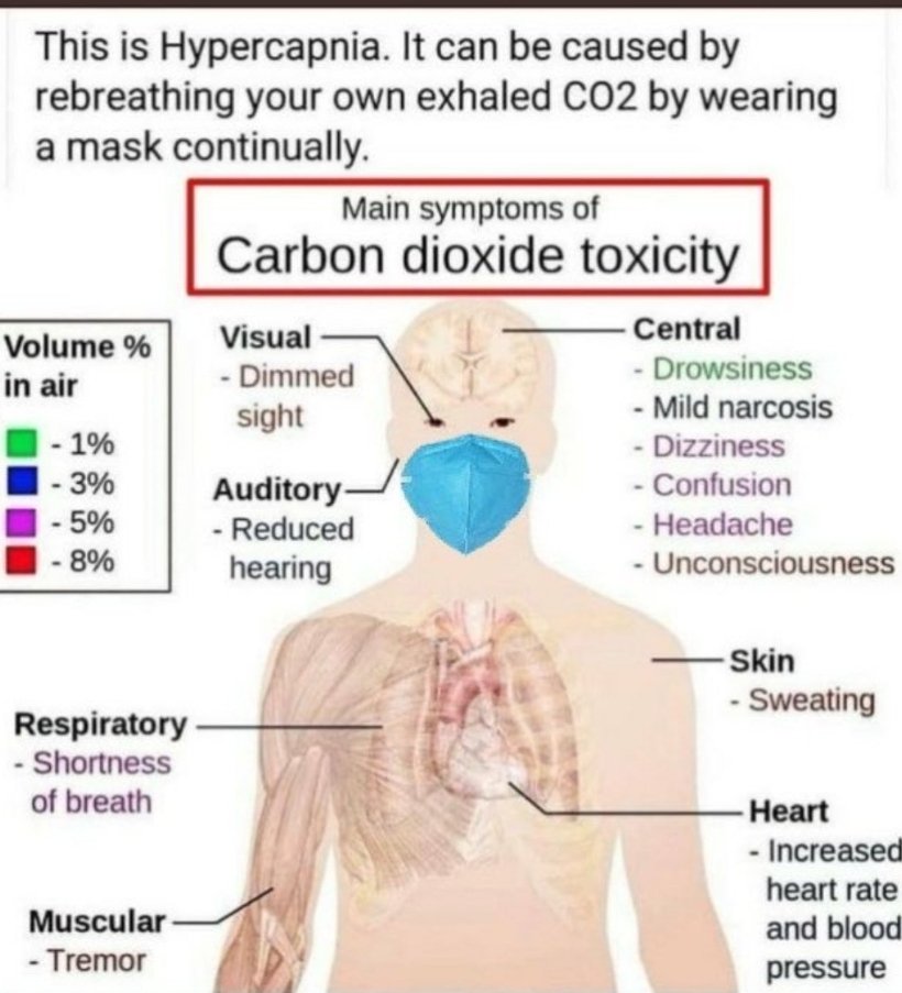 Picture for question