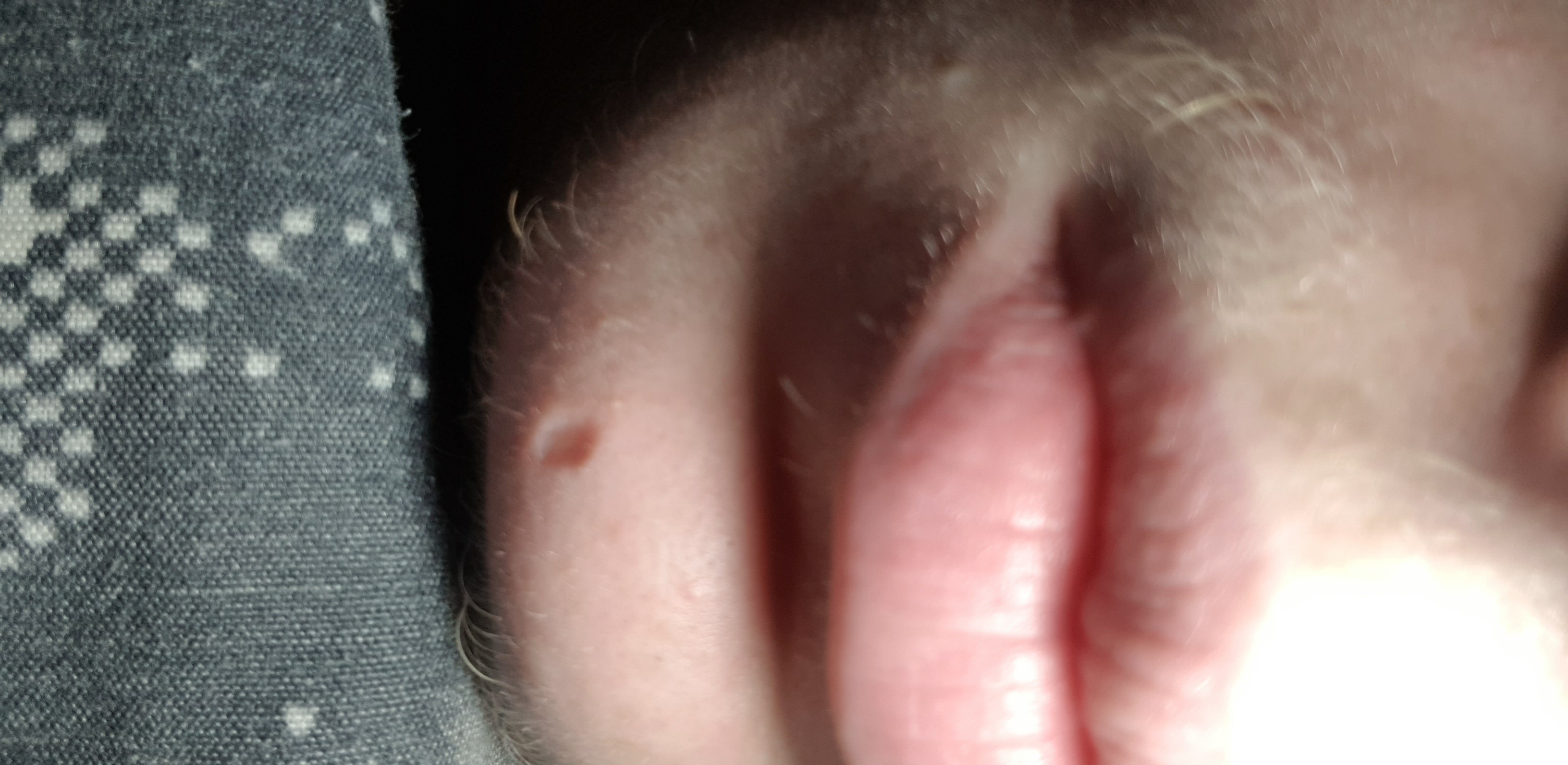 Picture for question