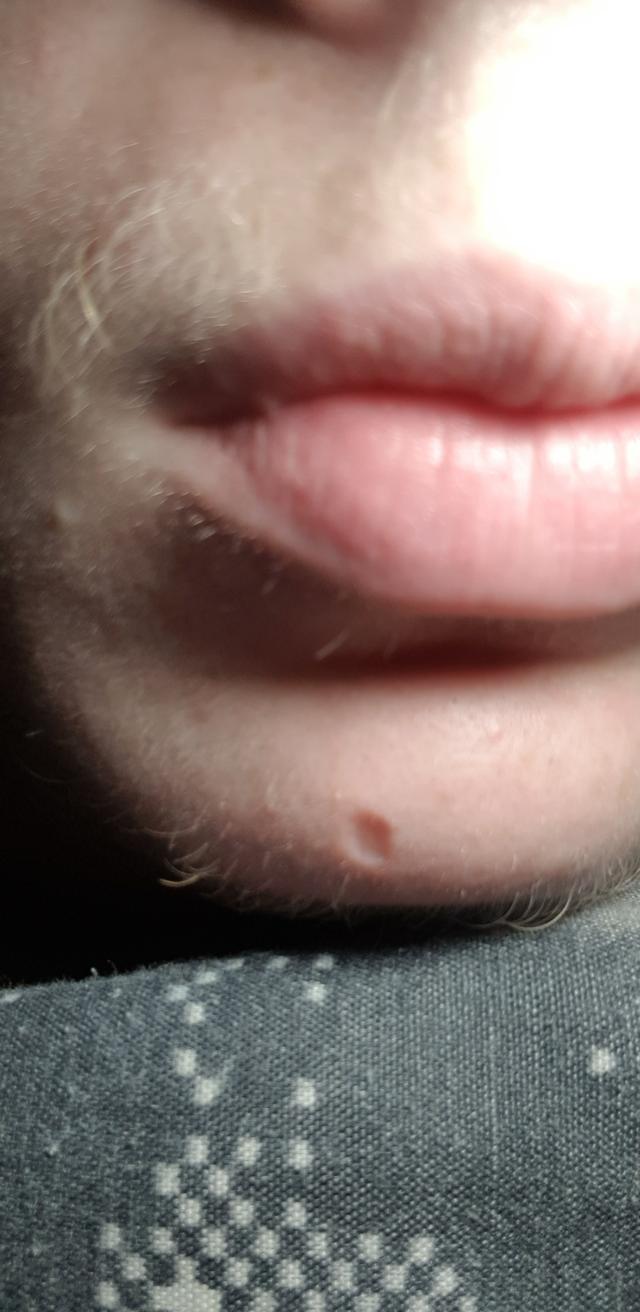 Picture for question