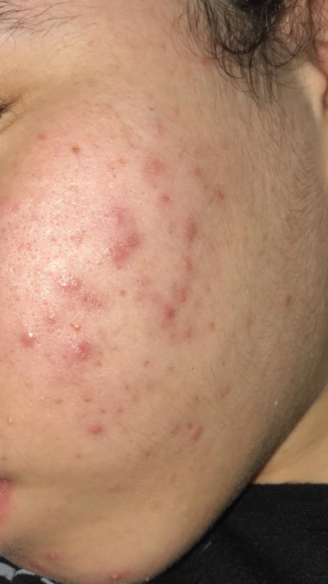 Picture for question