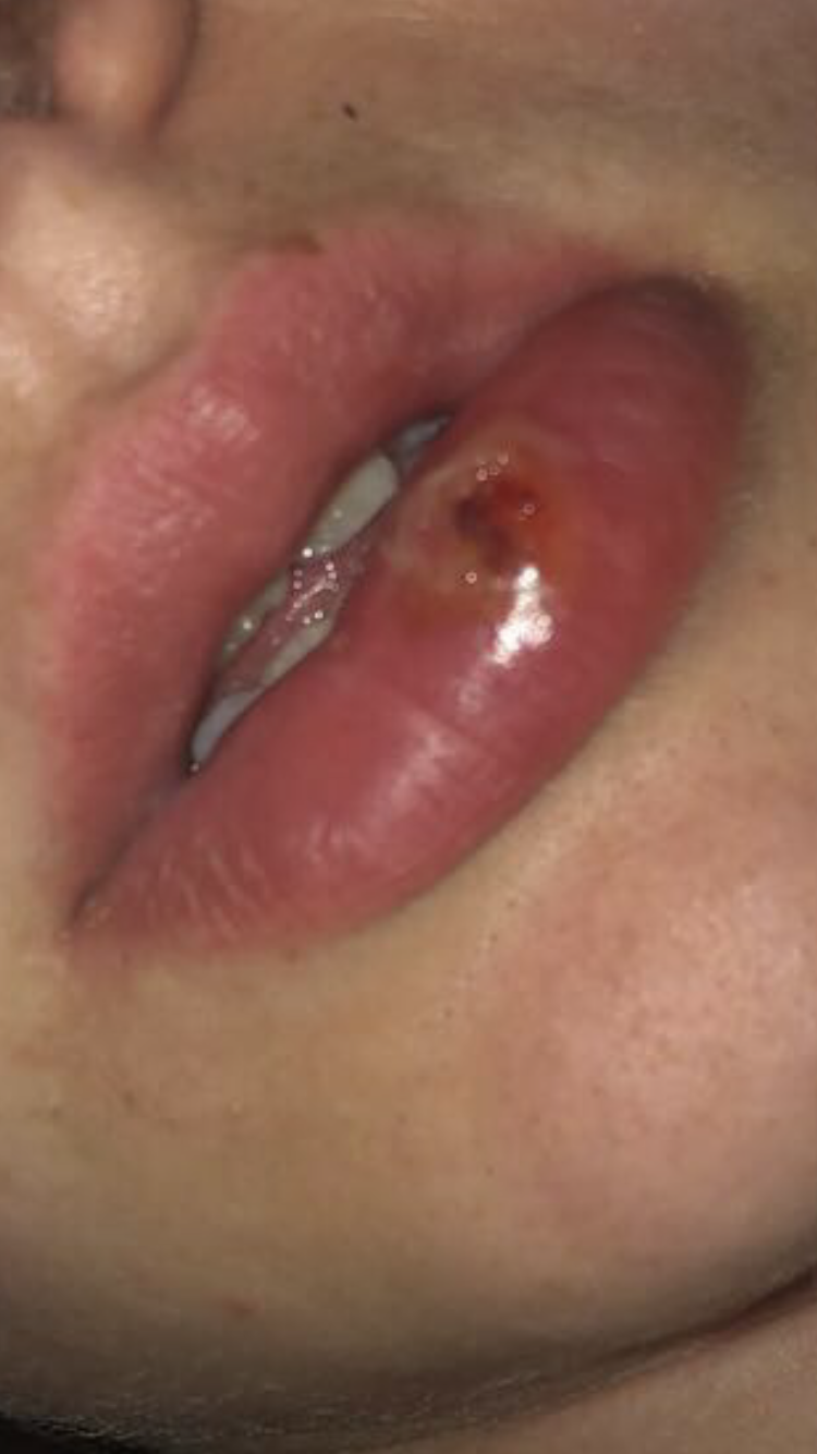 Picture for question