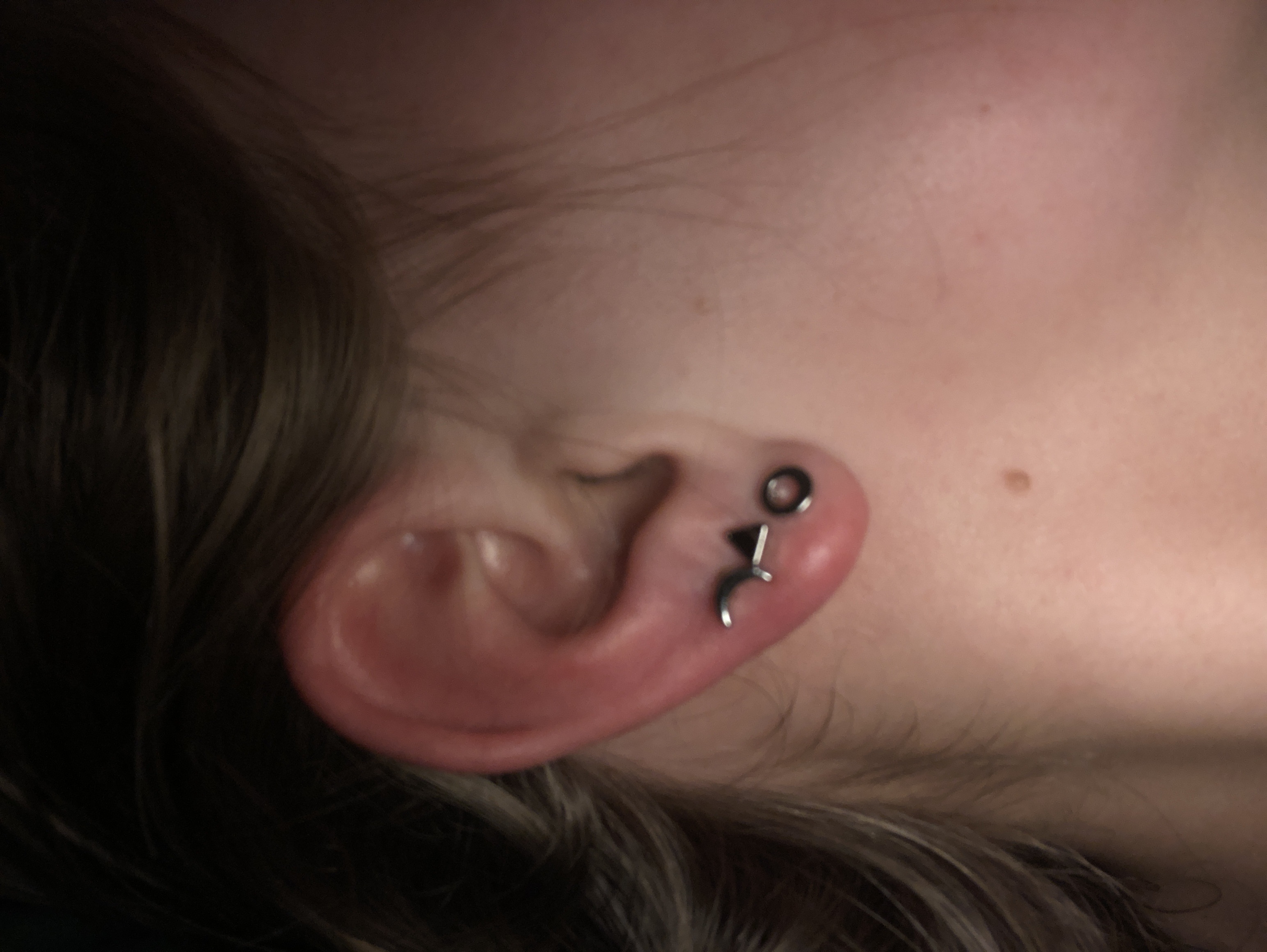 Picture for question